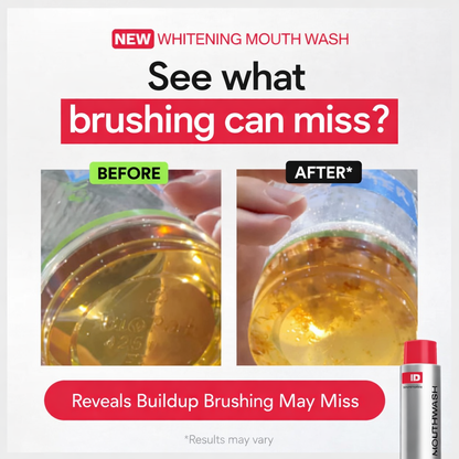 Whitiq Whitening Mouthwash™