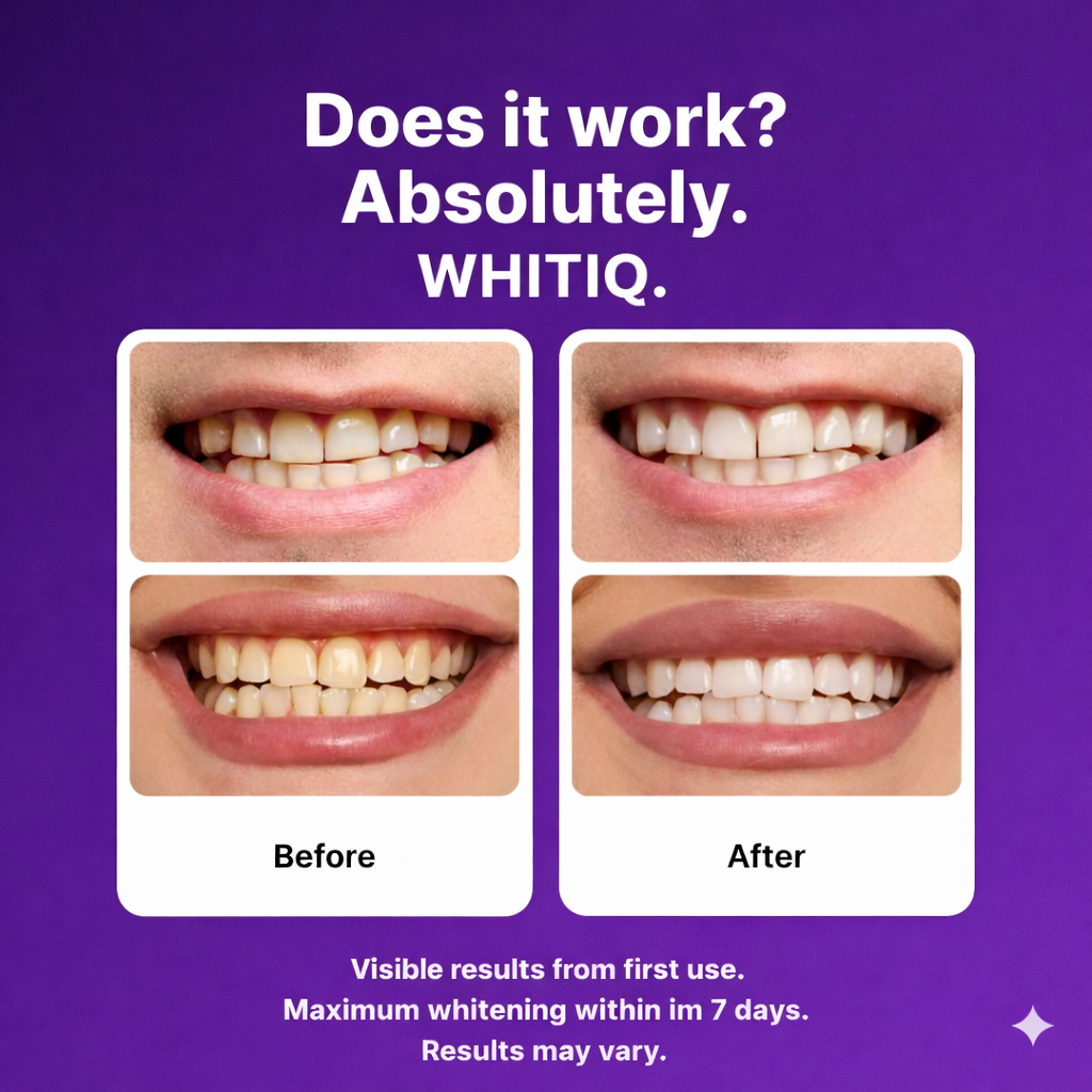 WHITIQ™ Color-Correct Whitening Strips